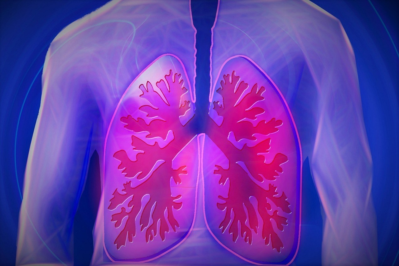 Antifungal Medicine Likely To Treat Cystic Fibrosis