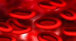 Study Reveals Link Between High PCB Levels In Blood And Early Death